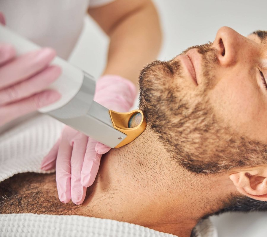 Épilation laser – Pour les hommes aussi !