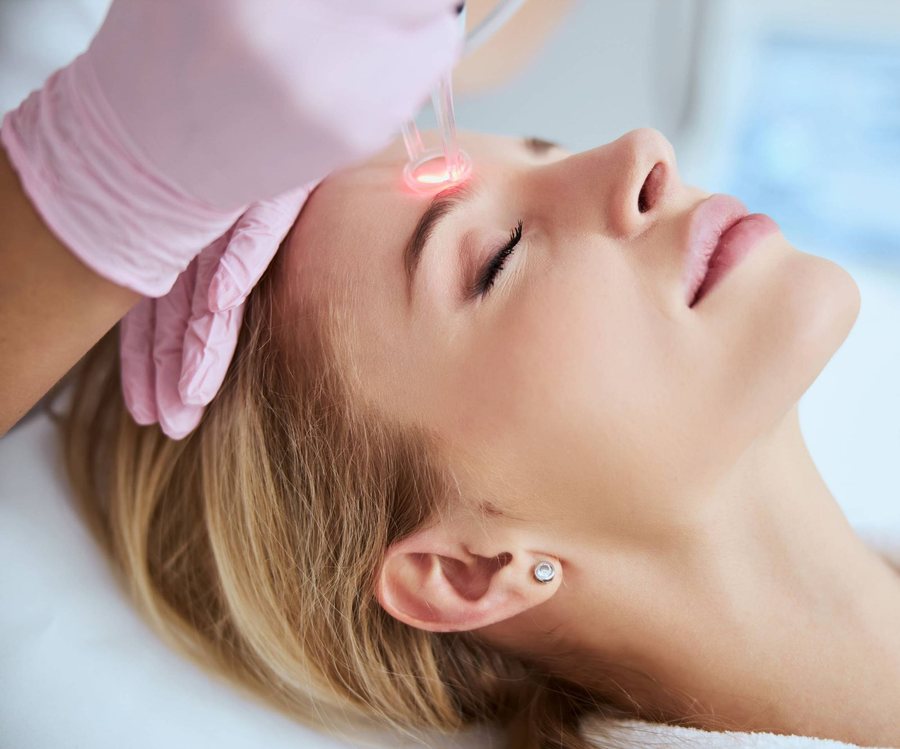 Autres traitements laser – Traiter le relâchement cutané du visage